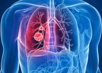 脾胃是健康的根，脾胃和口眼耳鼻、以及五臟的關(guān)聯(lián)全在這！